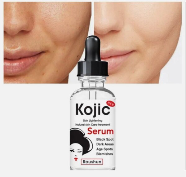 Kojic Skin lightening Natural skin treatment Face Serum 30ml - Image 3
