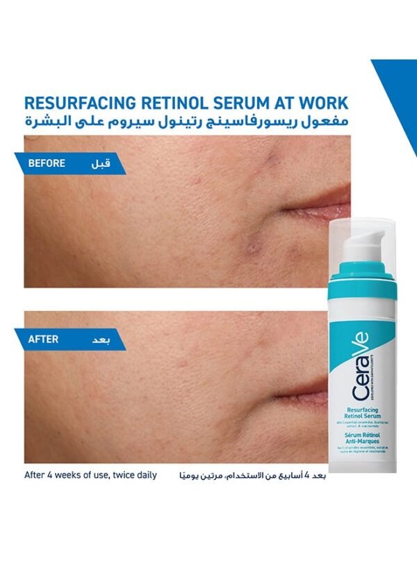 Cerave Skin Resurfacing Retinol Serum to Reduce the Appearance of Acne Scars and Pores with Retinol, Licorice Root Extract and Niacinamide 30ml - Image 9