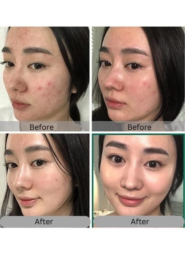 Jiaoli Miracle Day & Night Face Cream 20g*2 - Image 4