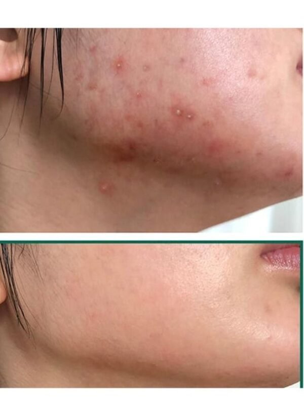 Jiaoli Miracle Day & Night Face Cream 20g*2 - Image 5