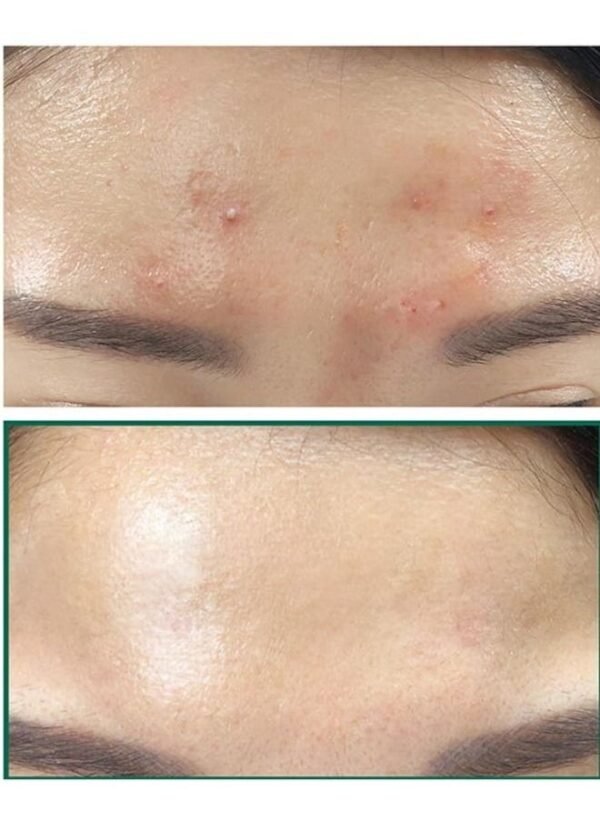 Jiaoli Miracle Day & Night Face Cream 20g*2 - Image 6