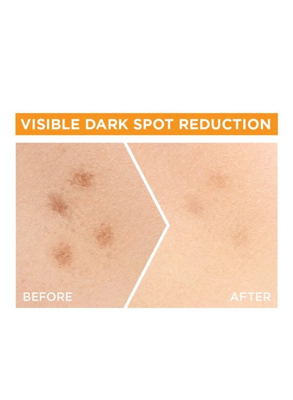 Garnier Fast Bright 30x Vitamin C Anti-Dark Spot Serum - 30ml - Image 4